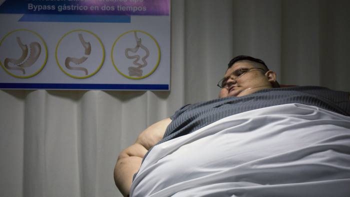 Diabetes sufferer Juan Pedro Franco weighed nearly 600kg, a world record, before dropping 170kg to undergo life-saving surgery