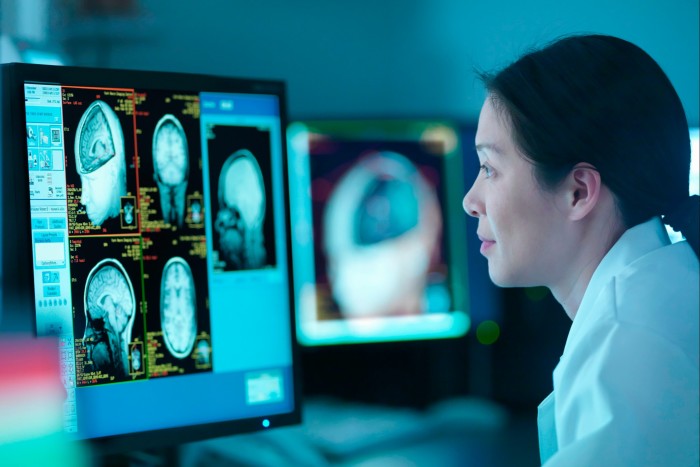 A doctor looking at a brain scan on a computer screen