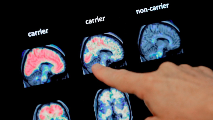 A doctor looks at a PET brain scan 