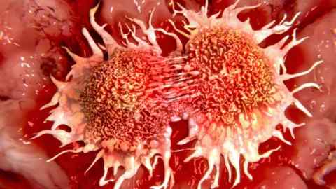 Two cancer cells (prostate cancer cells) in the mitotic process.