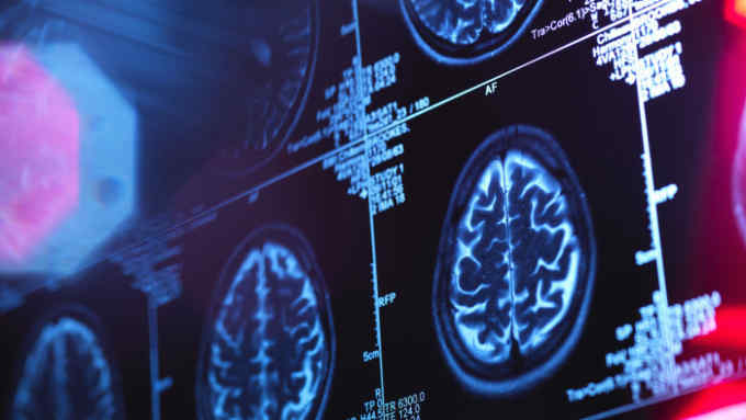Human brain scan in a neurology clinic